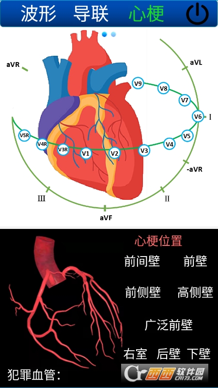 心电图计算器 V1.4.5截图3