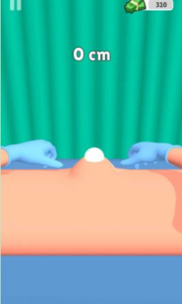 粉刺挤压游戏安卓版下载 V1.0截图1